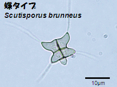 蝶タイプの半水生菌の胞子画像